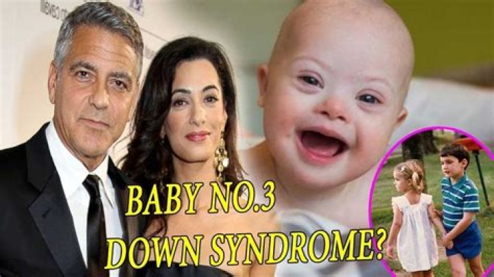 George Clooney's Down Syndrome Advocacy Makes A Difference
