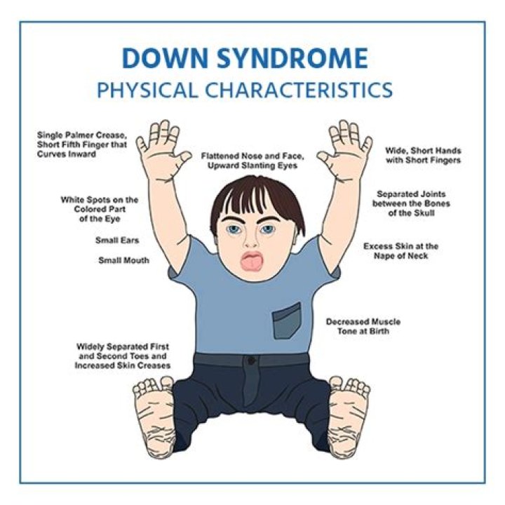 George Clooney's Possible Down Syndrome Child: Uncovering The Truth Behind The Rumors