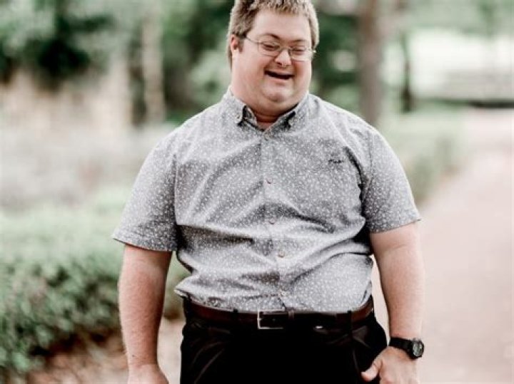 George Clooney's Son: Living With Down Syndrome