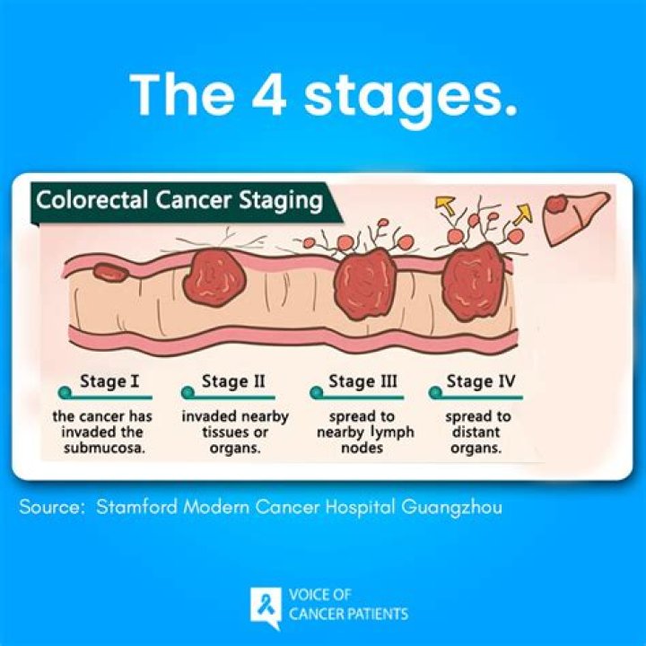 Pioneer Woman's Journey: Battling Stage 4 Colon Cancer