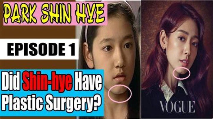 Shin Hye-sun Surgery: Unveiling The Story Behind The Star's Transformation