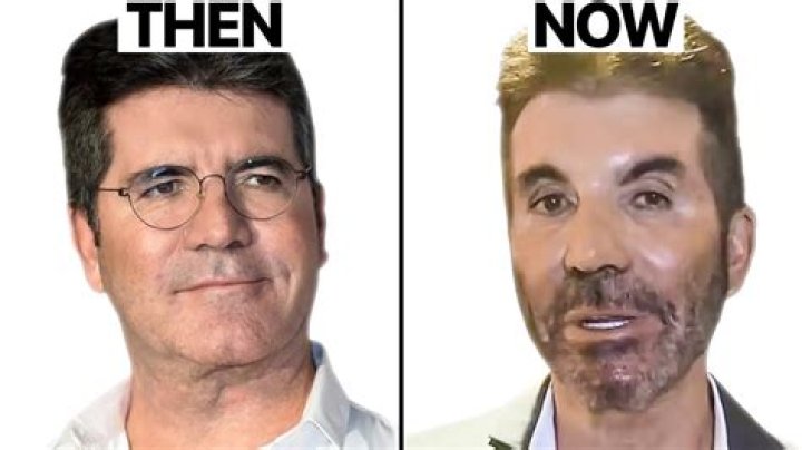 Simon Cowell's Latest Condition: What You Need To Know