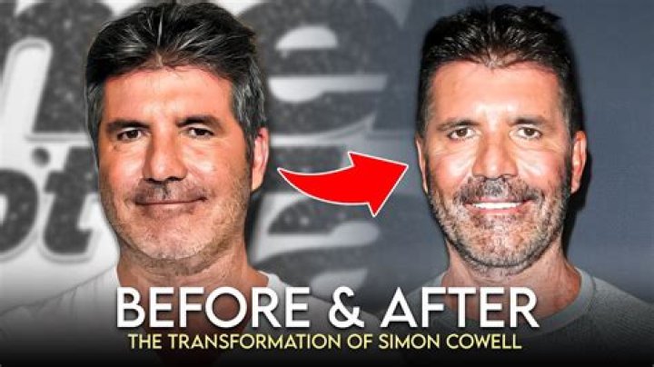 Simon Cowell: What Happened To Him?