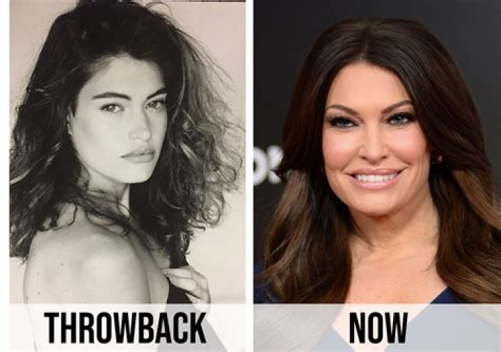 Transformations And Triumphs: Kimberly Guilfoyle Before And After