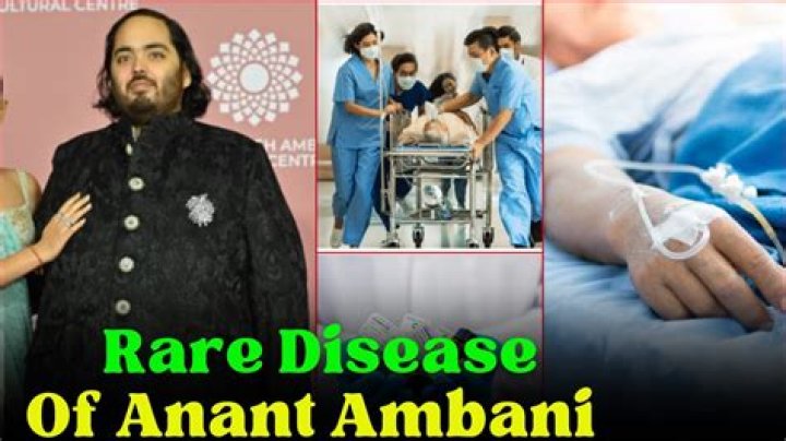 Unraveling The Health Mystery: What Disease Anant Ambani Is Having