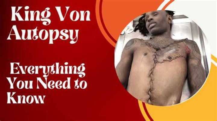 Unraveling The Mystery: King Von Autops