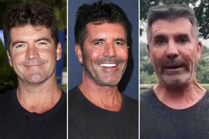 Unraveling The Mystery: What Is Wrong With Simon Cowell's Son?