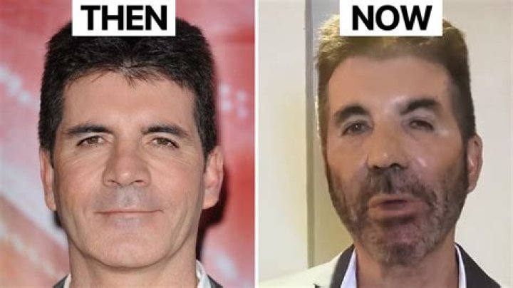 Unveiling The Mystery Of Simon Cowell's Lips
