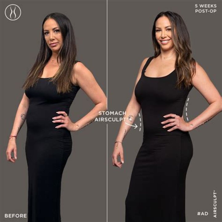 Unveiling The Truth: Did Kristen Doute Get Breast Implants?