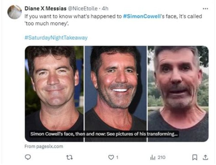 What Happened To Simon Cowell's Face? A Deep Dive Into The Controversy